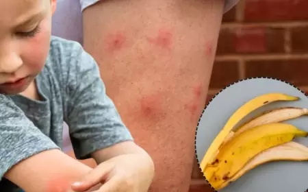 Tired of mosquito bites? Banana peels could be the solution you seem for