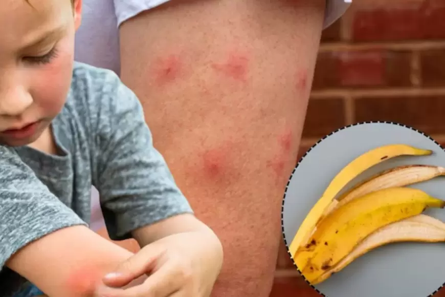 Tired of mosquito bites? Banana peels could be the solution you seem for