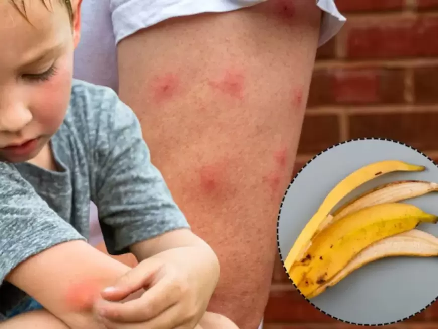 Tired of mosquito bites? Banana peels could be the solution you seem for